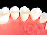 hbs03